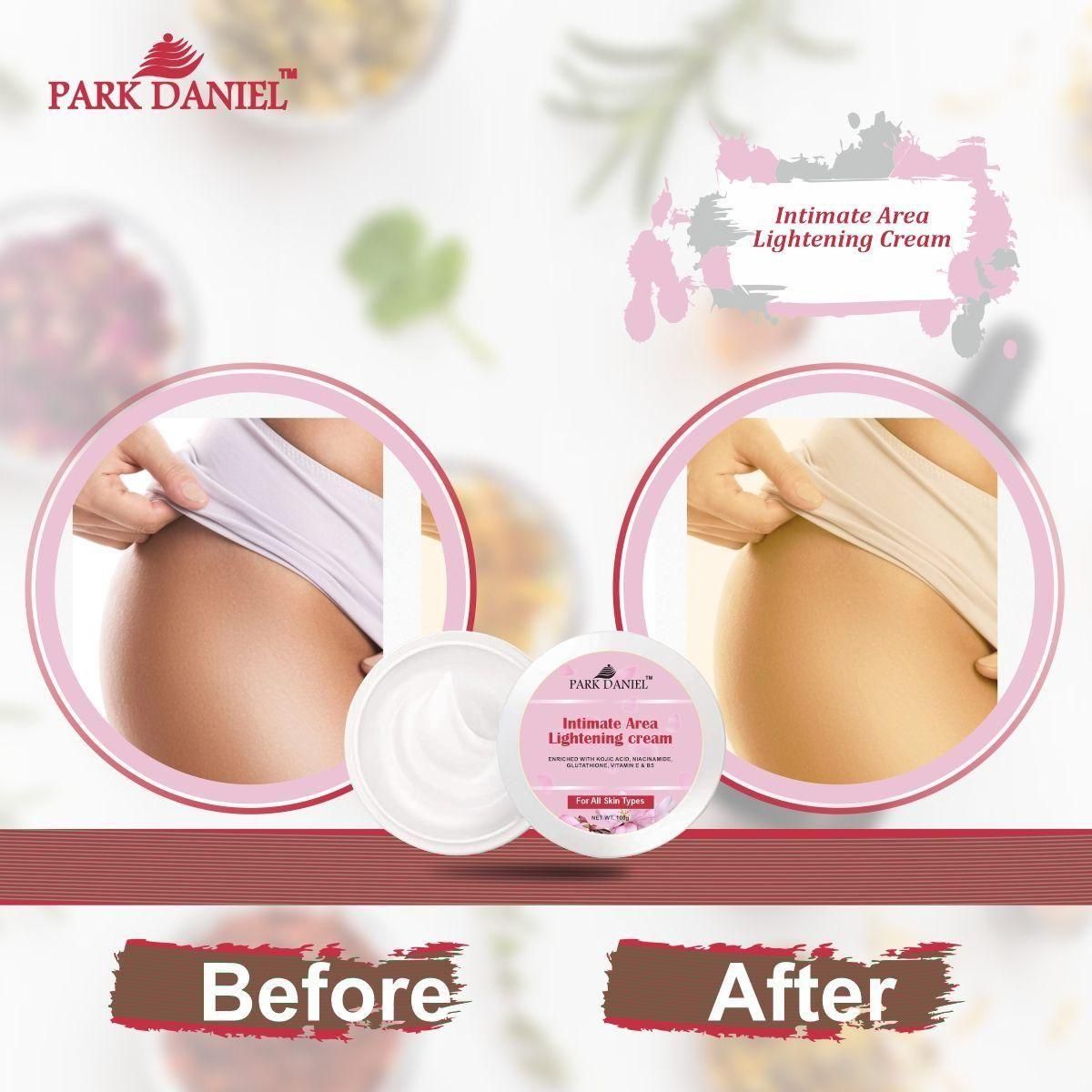 intimate area lightening cream