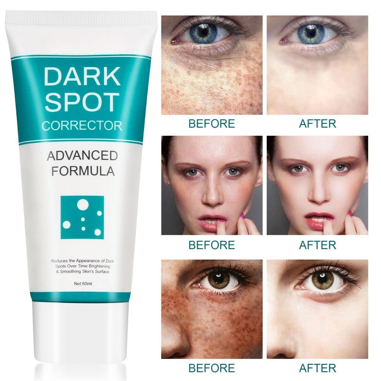 dark spot corrector