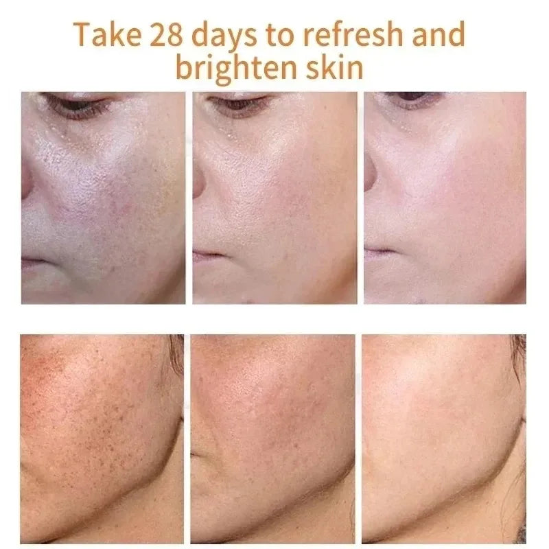 fades freckle dark spots - face cream with vitamin e