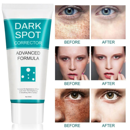 Dark Spot Corrector