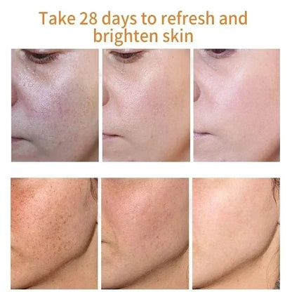 Fades Freckle Dark Spots - Face Cream With Vitamin E