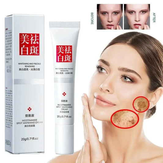 Fades Freckle Dark Spots - Face Cream With Vitamin E